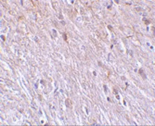 Anti-TTC5 antibody used in IHC (Paraffin sections) (IHC-P). GTX85519