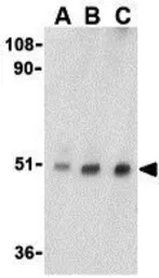 Anti-TTC5 antibody used in Western Blot (WB). GTX85519