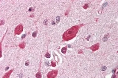 Anti-DDB1 antibody used in IHC (Paraffin sections) (IHC-P). GTX85639
