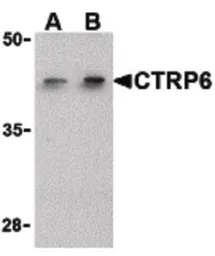 Anti-CTRP6 antibody used in Western Blot (WB). GTX85669