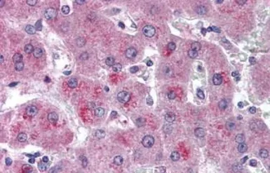 Anti-HTRA3 antibody used in IHC (Paraffin sections) (IHC-P). GTX85675
