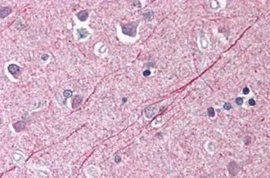 Anti-PHAP3 antibody used in IHC (Paraffin sections) (IHC-P). GTX85687