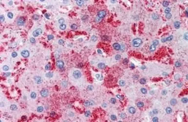 Anti-MUC13 antibody used in IHC (Paraffin sections) (IHC-P). GTX85717