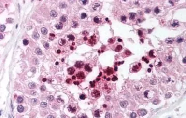 Anti-RIF1 antibody used in IHC (Paraffin sections) (IHC-P). GTX85728