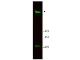 Anti-RIF1 antibody used in Western Blot (WB). GTX85728