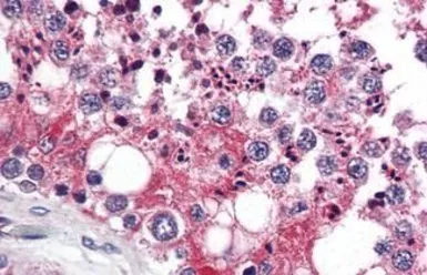 Anti-RAP80 antibody used in IHC (Paraffin sections) (IHC-P). GTX85735