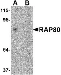 Anti-RAP80 antibody used in Western Blot (WB). GTX85735