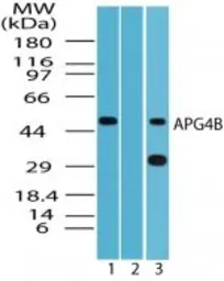 Anti-ATG4B antibody used in Western Blot (WB). GTX85759