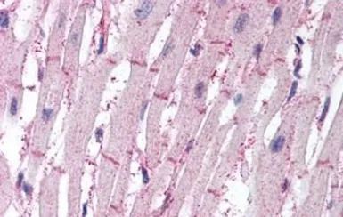 Anti-ATG4B antibody used in IHC (Paraffin sections) (IHC-P). GTX85759