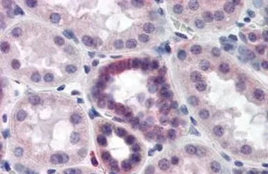 Anti-CAND2 antibody used in IHC (Paraffin sections) (IHC-P). GTX85760
