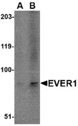 Anti-TMC6 antibody used in Western Blot (WB). GTX85762