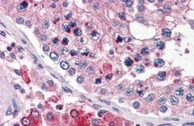 Anti-TMC6 antibody used in IHC (Paraffin sections) (IHC-P). GTX85762