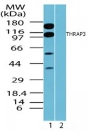 Anti-THRAP3 antibody used in Western Blot (WB). GTX85787