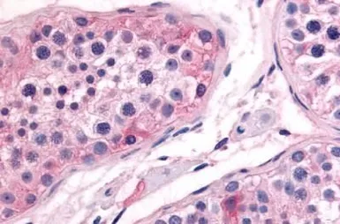 Anti-PTGES antibody used in IHC (Paraffin sections) (IHC-P). GTX85793