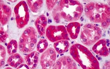 Anti-SLIT1 antibody used in IHC (Paraffin sections) (IHC-P). GTX85822