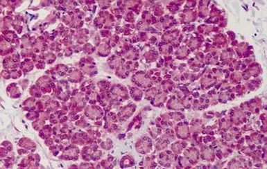 Anti-SLIT1 antibody used in IHC (Paraffin sections) (IHC-P). GTX85822