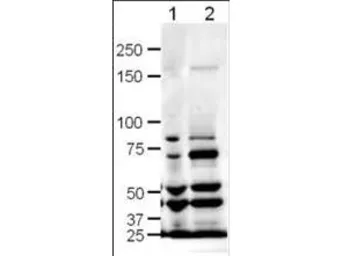 Anti-SLIT1 antibody used in Western Blot (WB). GTX85822