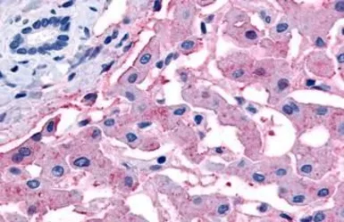 Anti-SLC5A4 antibody used in IHC (Paraffin sections) (IHC-P). GTX85824