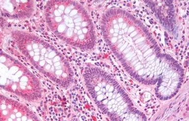 Anti-SLC5A4 antibody used in IHC (Paraffin sections) (IHC-P). GTX85824