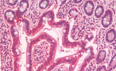 Anti-SLC5A4 antibody used in IHC (Paraffin sections) (IHC-P). GTX85824