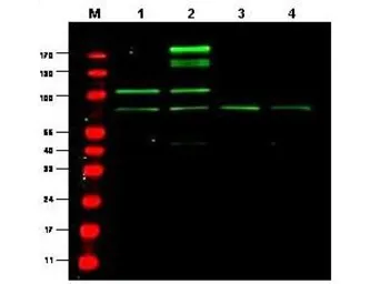 Anti-RREB1 antibody used in Western Blot (WB). GTX85830