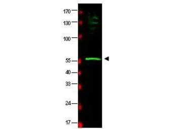 Anti-RAD23B antibody used in Western Blot (WB). GTX85831