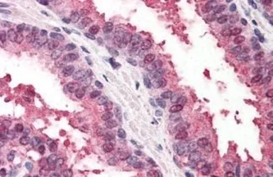 Anti-RAD23B antibody used in IHC (Paraffin sections) (IHC-P). GTX85831