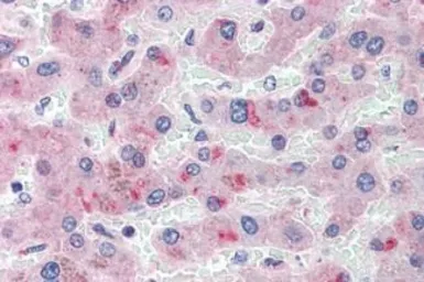 Anti-LPA antibody used in IHC (Paraffin sections) (IHC-P). GTX85859