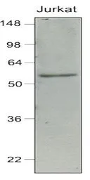 Anti-IRF7 antibody [3D9] used in Western Blot (WB). GTX85864