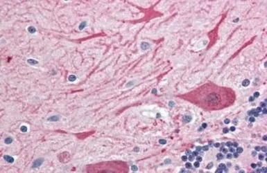 Anti-Syntaxin 2 antibody used in IHC (Paraffin sections) (IHC-P). GTX85883