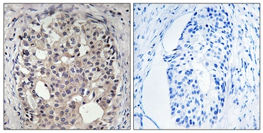 Anti-CDC25A (phospho Ser178) antibody used in IHC (Paraffin sections) (IHC-P). GTX86031