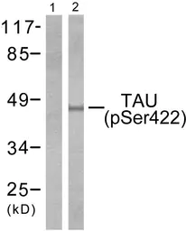 Anti-Tau (phospho Ser422) antibody used in Western Blot (WB). GTX86147