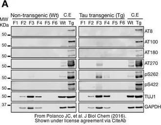Anti-Tau (phospho Ser422) antibody used in Western Blot (WB). GTX86147