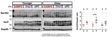 Anti-Tau (phospho Ser422) antibody used in Western Blot (WB). GTX86147