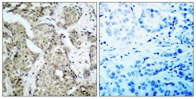 Anti-MEK3 (phospho Ser189) antibody used in IHC (Paraffin sections) (IHC-P). GTX86304