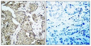 Anti-MEK3 (phospho Ser189) antibody used in IHC (Paraffin sections) (IHC-P). GTX86304