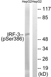 Anti-IRF3 (phospho Ser386) antibody used in Western Blot (WB). GTX86736
