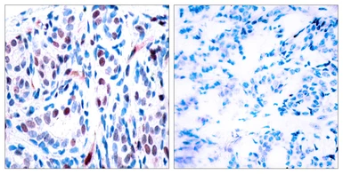 Anti-STAT3 (phospho Tyr705) antibody used in IHC (Paraffin sections) (IHC-P). GTX86741