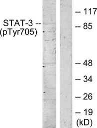 Anti-STAT3 (phospho Tyr705) antibody used in Western Blot (WB). GTX86741