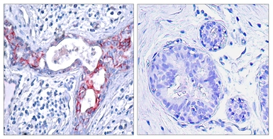 Anti-GSK3 beta (phospho Ser9) antibody used in IHC (Paraffin sections) (IHC-P). GTX86837