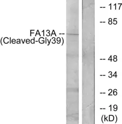 Anti-Factor XIIIa (cleaved Gly39) antibody used in Western Blot (WB). GTX86889