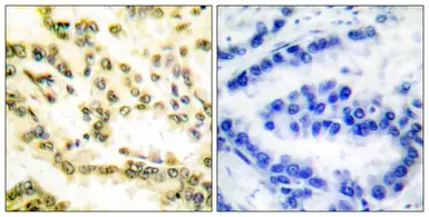 Anti-Lamin A (cleaved Asp230) antibody used in IHC (Paraffin sections) (IHC-P). GTX86913
