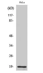 Anti-Thyroid Hormone Receptor beta (cleaved Arg327) antibody used in Western Blot (WB). GTX86914