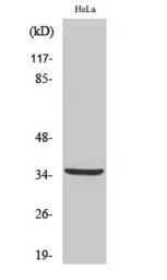 Anti-Cathepsin V (cleaved Leu114) antibody used in Western Blot (WB). GTX86922