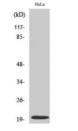 Anti-Caspase 5 (cleaved Asp121) antibody used in Western Blot (WB). GTX86923