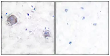 Anti-NOTCH1 (cleaved Val1754) antibody used in IHC (Paraffin sections) (IHC-P). GTX86924