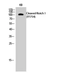 Anti-NOTCH1 (cleaved Val1754) antibody used in Western Blot (WB). GTX86924