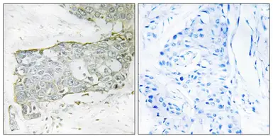 Anti-Factor VII (cleaved Arg212) antibody used in IHC (Paraffin sections) (IHC-P). GTX86939