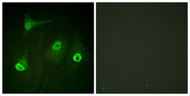 Anti-NFkB p65 (acetyl Lys310) antibody used in Immunocytochemistry/ Immunofluorescence (ICC/IF). GTX86963