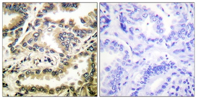 Anti-NFkB p65 (acetyl Lys310) antibody used in IHC (Paraffin sections) (IHC-P). GTX86963